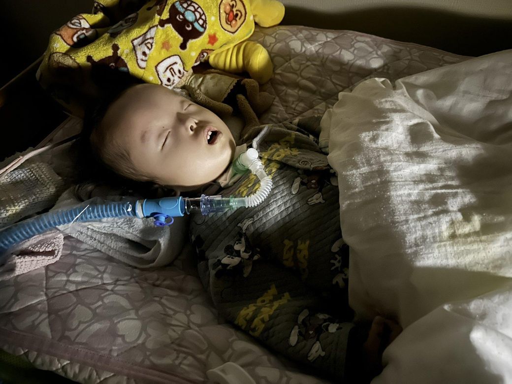 呼吸器ひとつとっても必要経費はバカにならない（写真：松原さん提供）