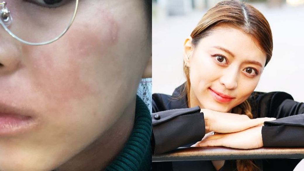 筋トレによって性格が外向的になった種村さん。マインド以外にも筋トレによって変化した3つあるという（写真：本人提供、筆者撮影）