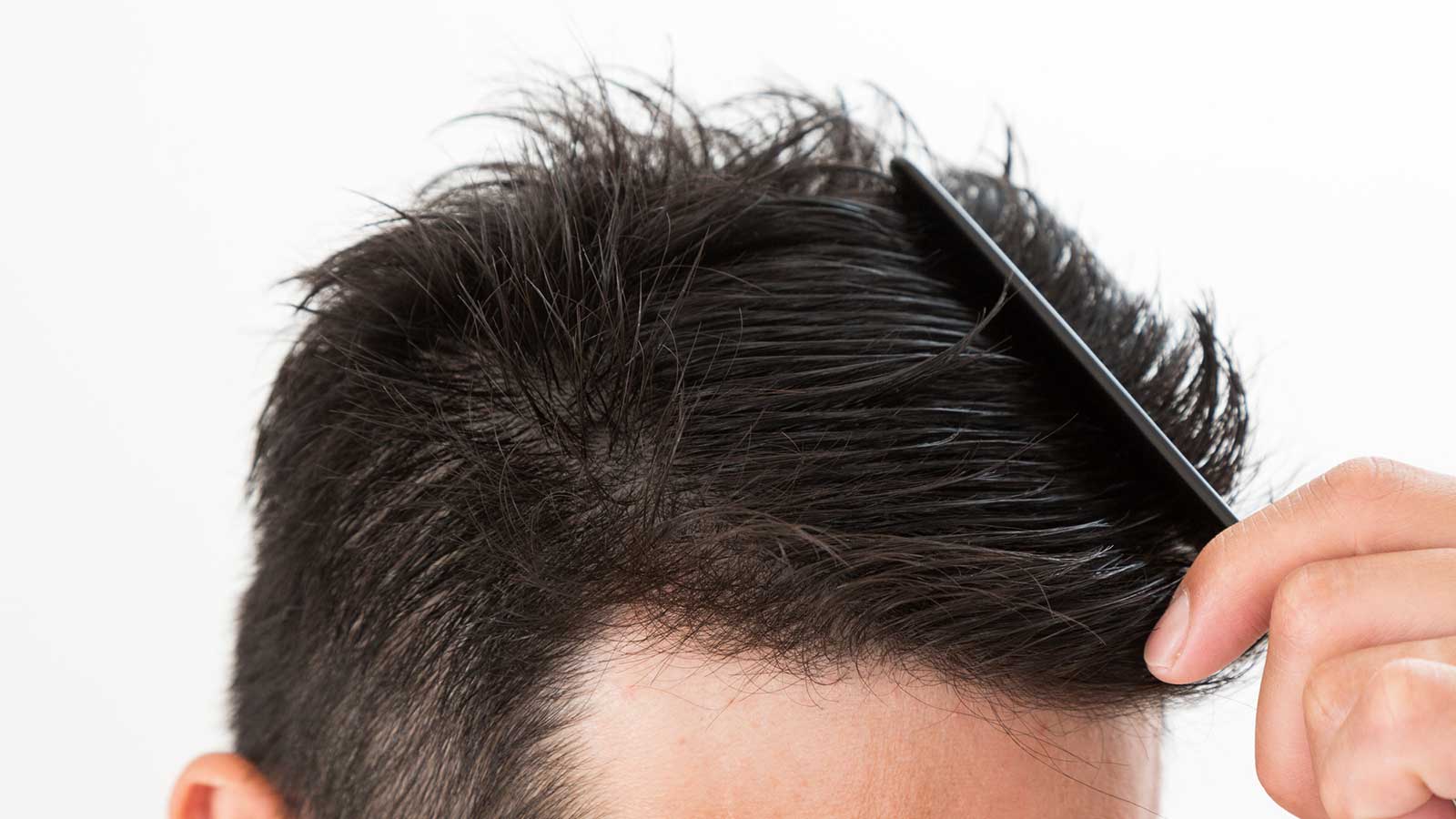 薄毛 前頭部 髪型 【薄毛 カット】前頭部（M）と頭頂部（O）が同時に薄くなってきたヘアスタイルをデザインする。