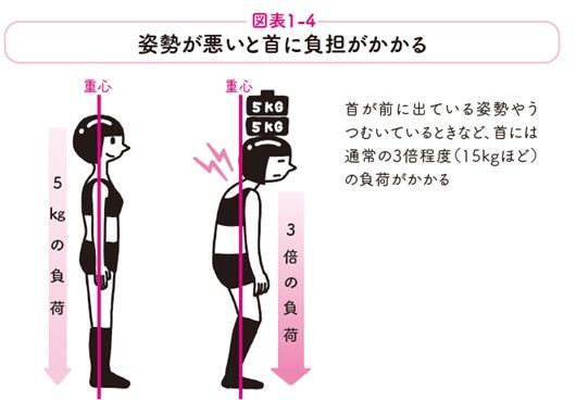 姿勢が悪いと首に負担がかかる