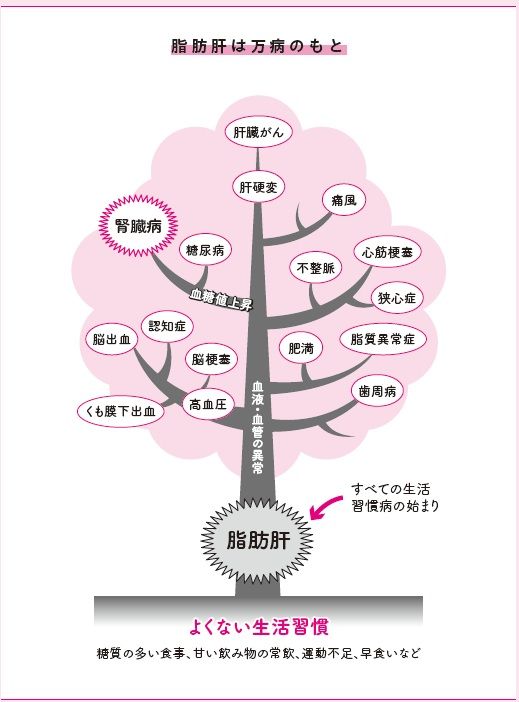 脂肪肝は万病のもと