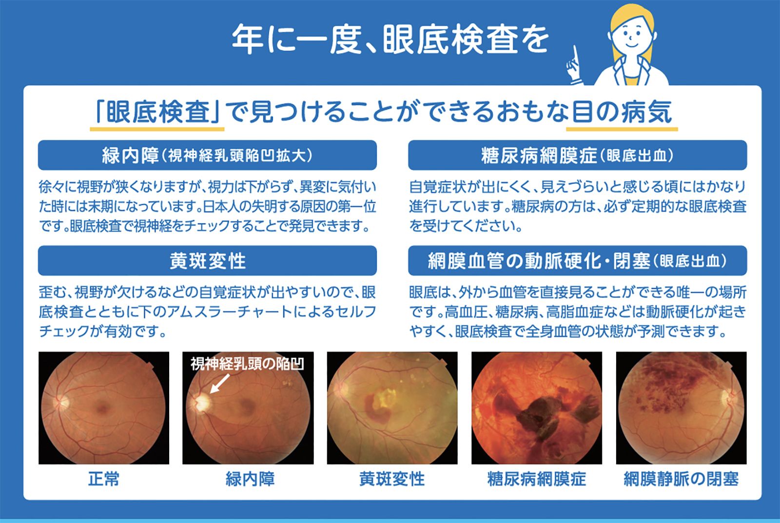 眼底検査で見つけられる主な目の病気